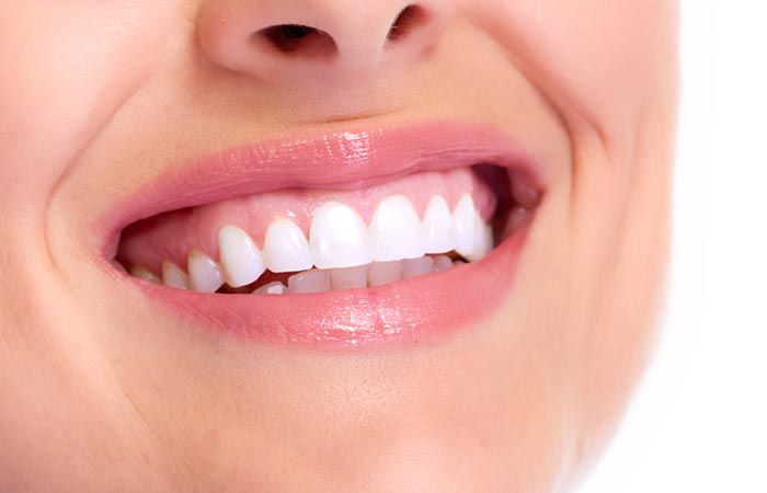 Điều trị cười hở lợi tại YenLe Dental